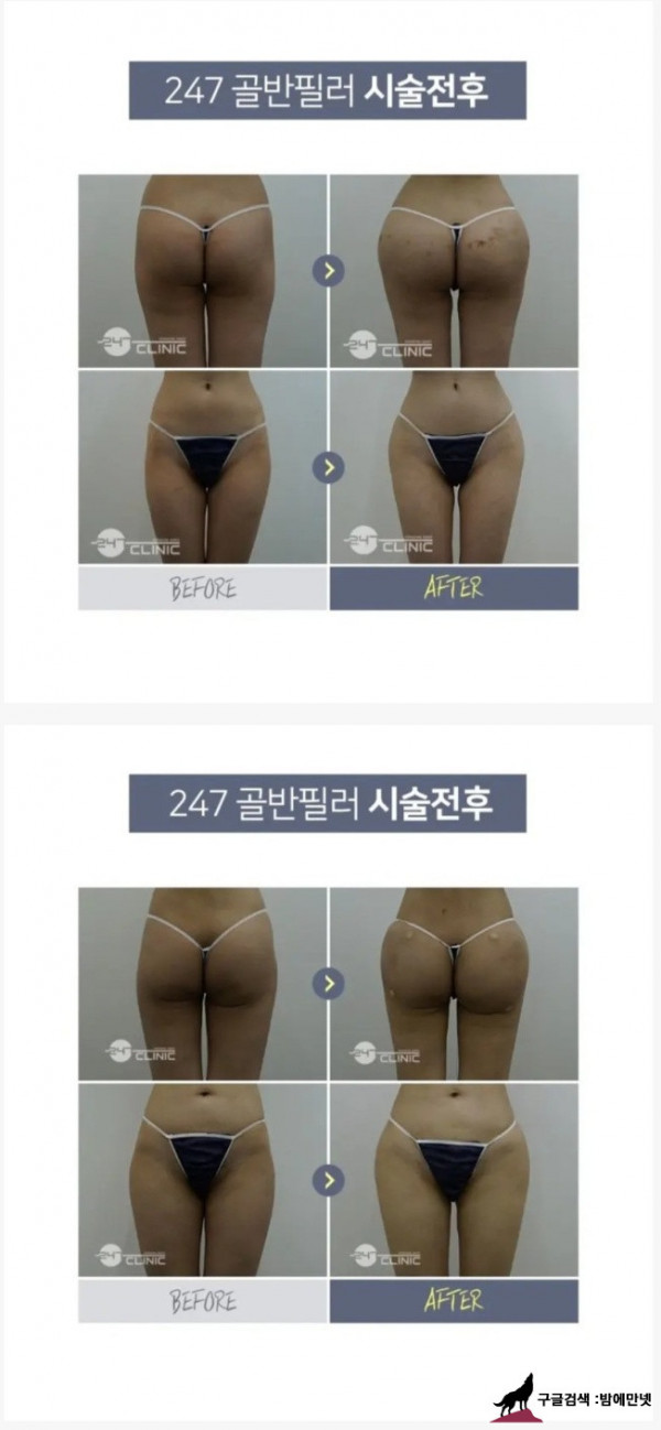 후방) 요즘 여자들 골반도 다 짭인 이유 img #1